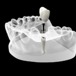 chirurgia dentale all'avanguardia